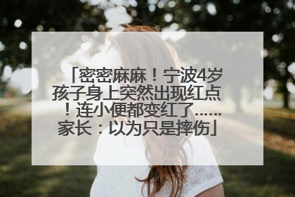 密密麻麻！宁波4岁孩子身上突然出现红点！连小便都变红了……家长：以为只是摔伤