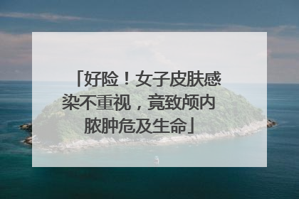 好险！女子皮肤感染不重视，竟致颅内脓肿危及生命